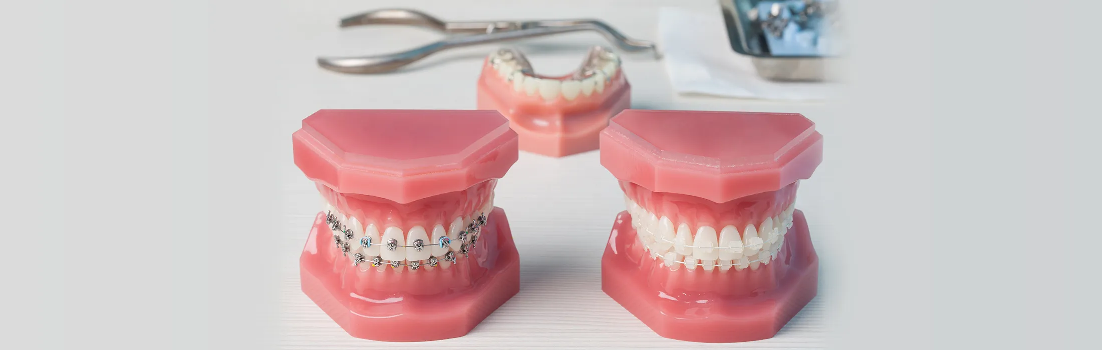 大人と10代(成長終了後)の矯正治療