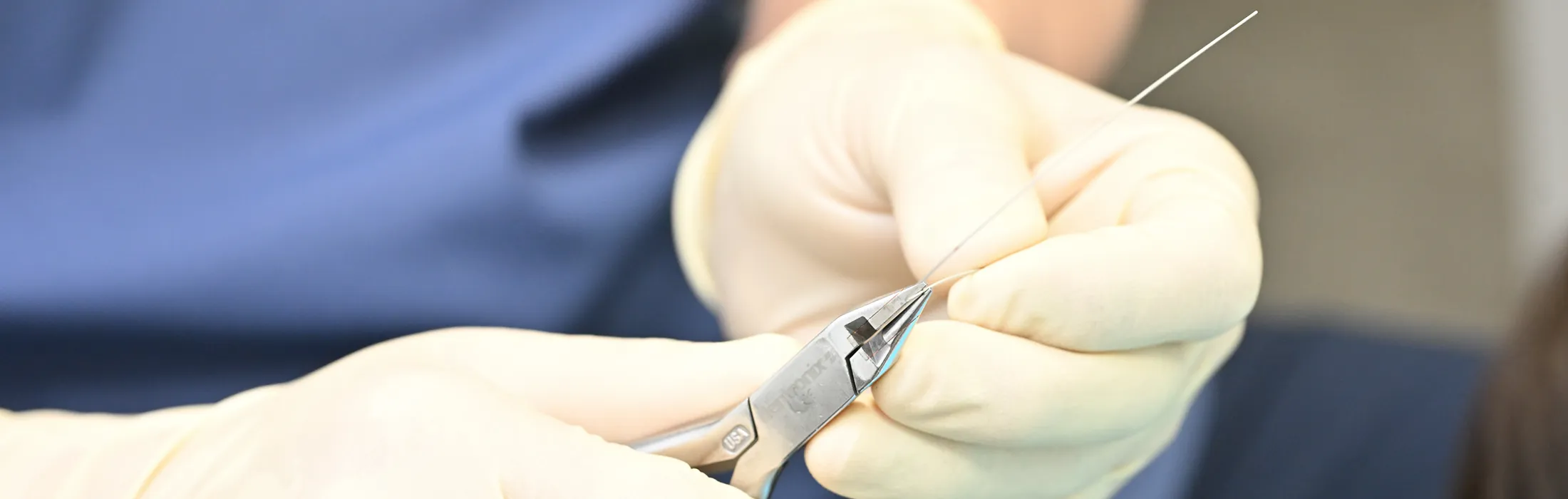 大人と10代の矯正装置