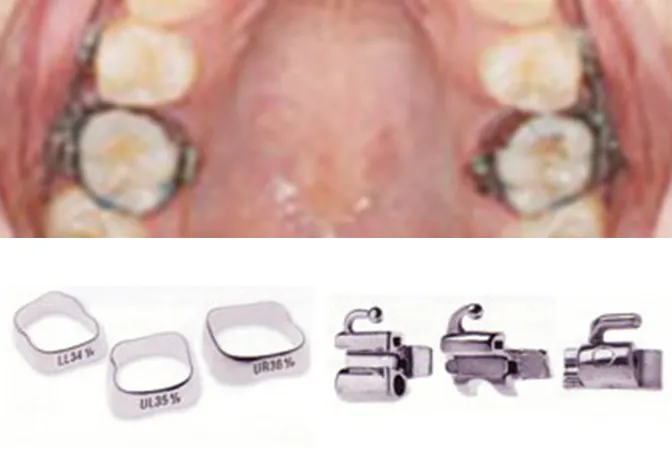 バンドとチューブ