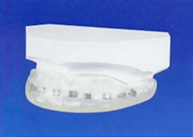 スポーツマウスガード