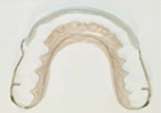 当院オリジナルの透明なパッド付き保定装置01