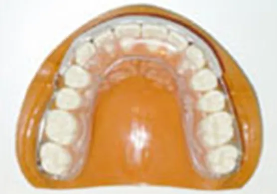 当院オリジナルの透明なパッド付き保定装置03