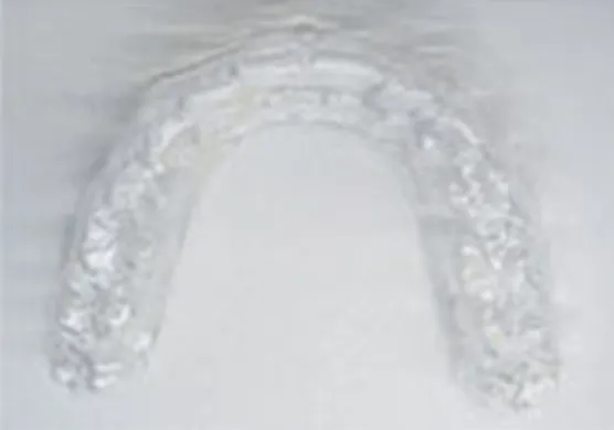 可撤式保定装置(クリアリテーナー)01