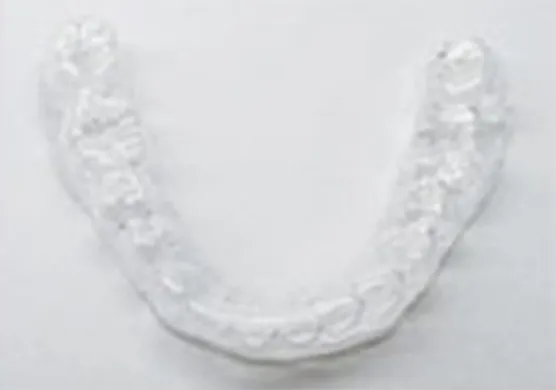 可撤式保定装置(クリアリテーナー)02