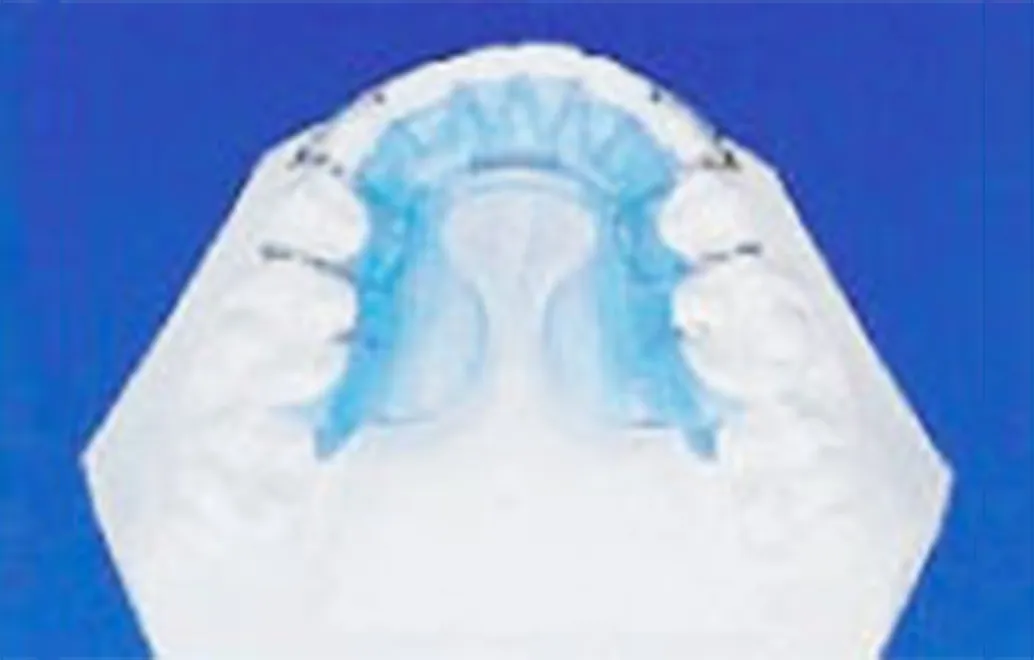 筋機能療法（MFT＝口腔周囲筋トレーニング）症例01