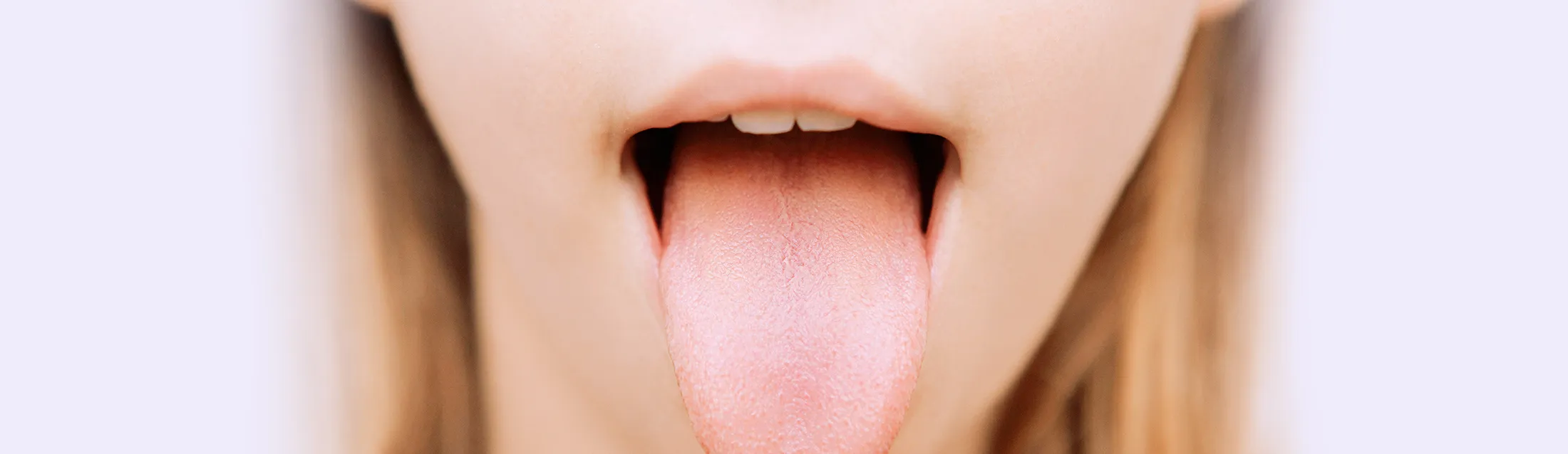 筋機能療法（MFT＝口腔周囲筋トレーニング）