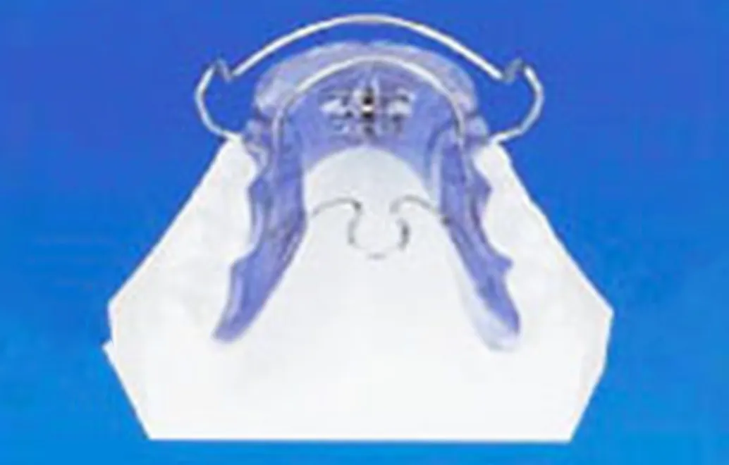 下顎の成長を促進させる装置