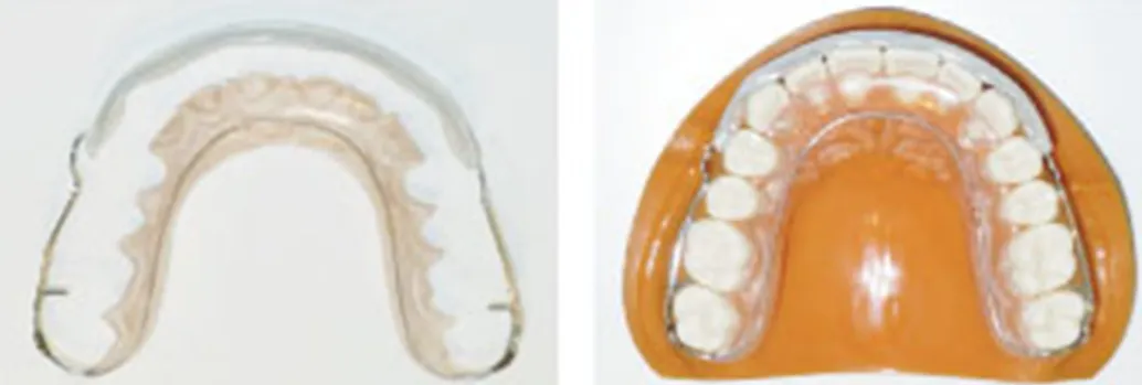 当院オリジナルの透明なパッド付き保定装置